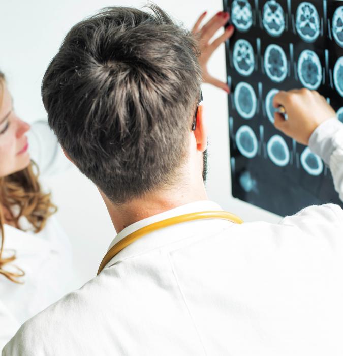 X-rays of the brain being examined by doctors. 